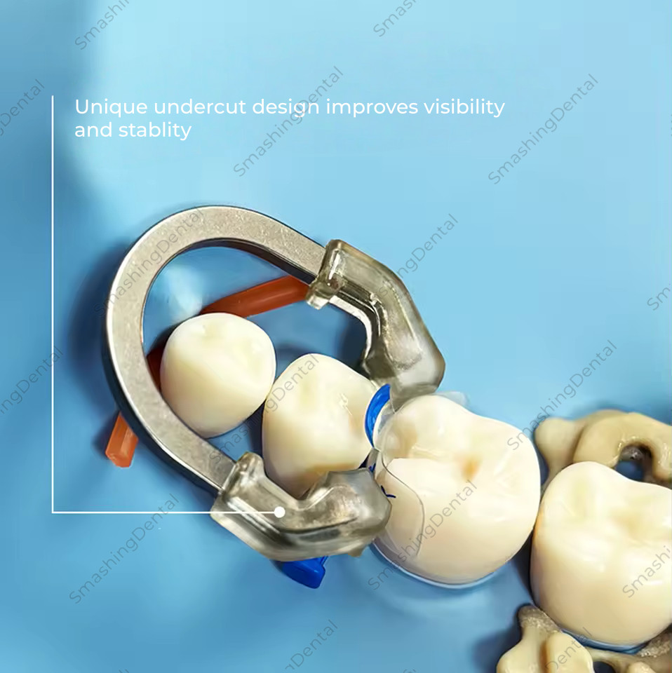 Dental NITI Transparent Matrix Clip Ring Sectional Matrix Clamp Elastic Clear US