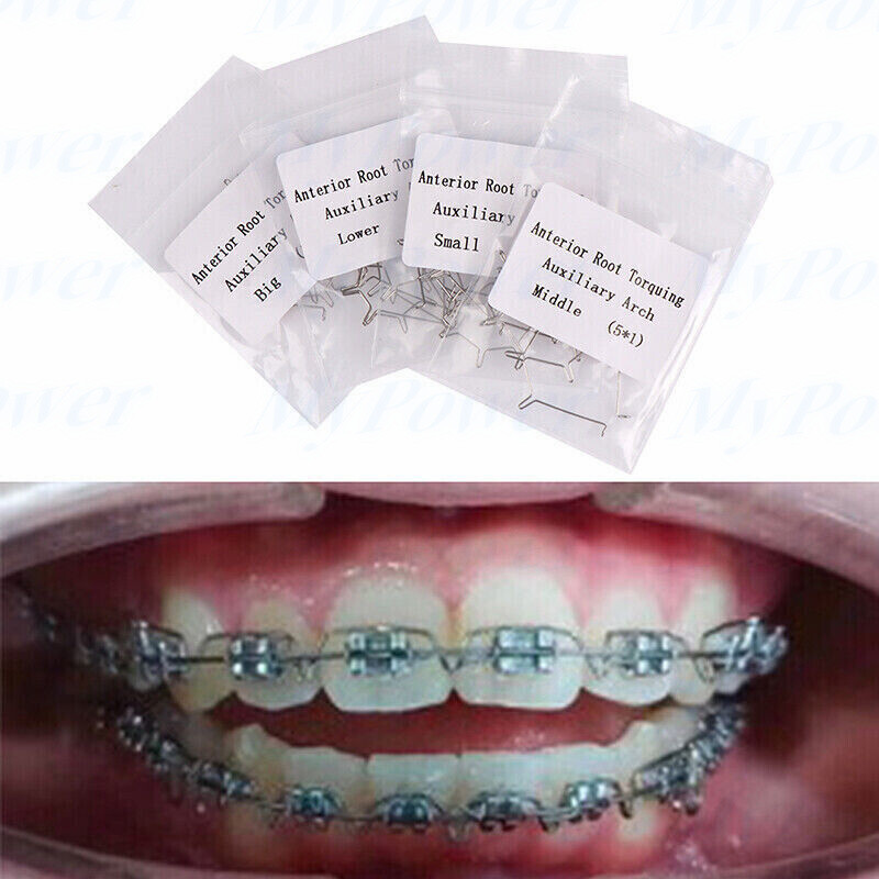 Dental Ortho Anterior Root Torquing Auxiliary Arch Wires Big/Small/ Middle/Lower