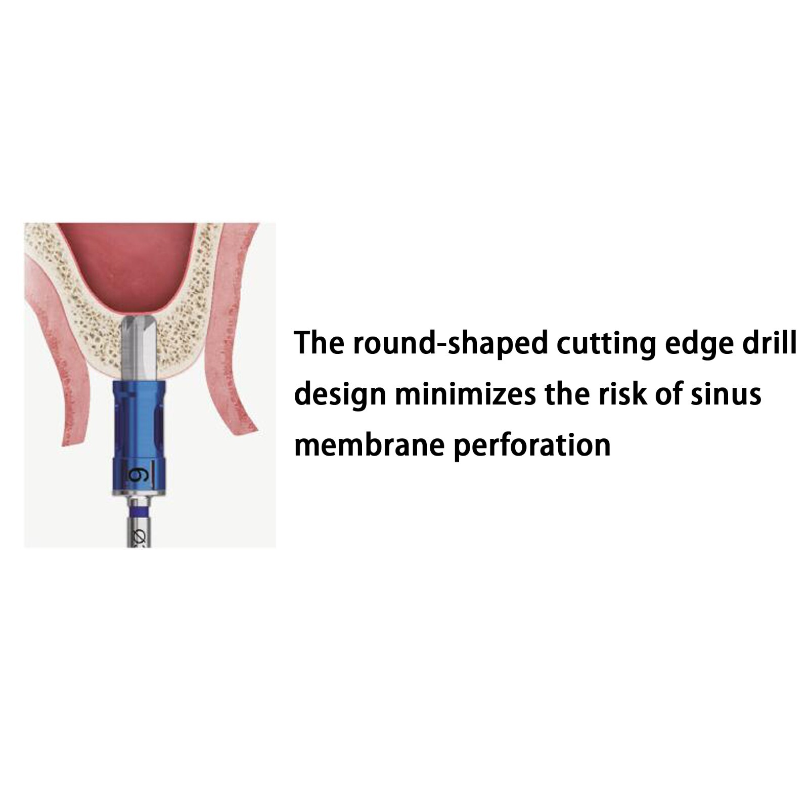 Implant Sinus Lift Kit CAS Hiossen Crestal Approach Hydraulic Membrane Lifter