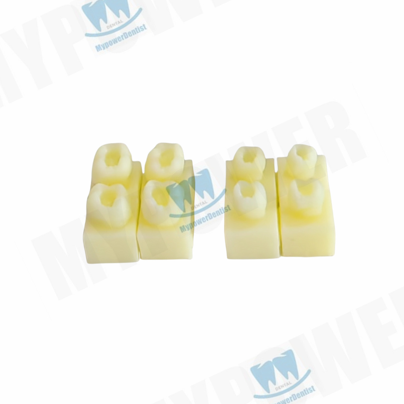 Dental Cavity Preparation/Vitro Decay Caries Model/Composite Resin Filling Model