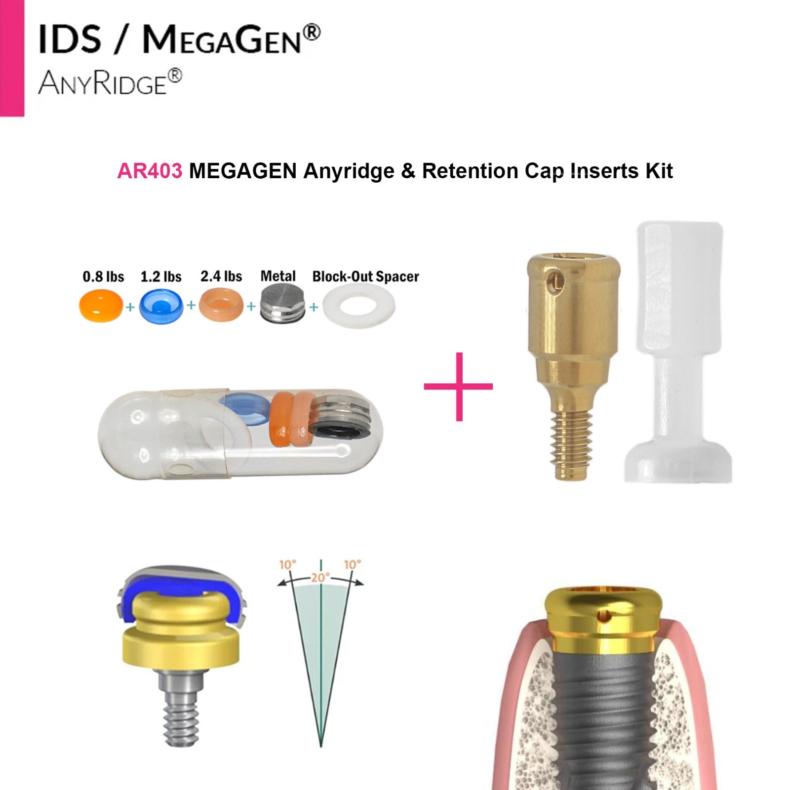 Dental Overdenture Locator Abutment Anchor for MEGAGEN AnyRidge 4.0 Platform Cap