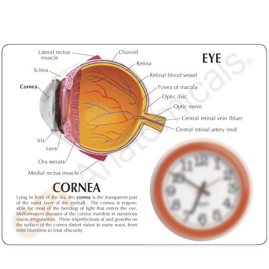 Eye Cataract Cornea Eye Set of 3 GPI Anatomy Models #4021 Make Offer! SEE VIDEO