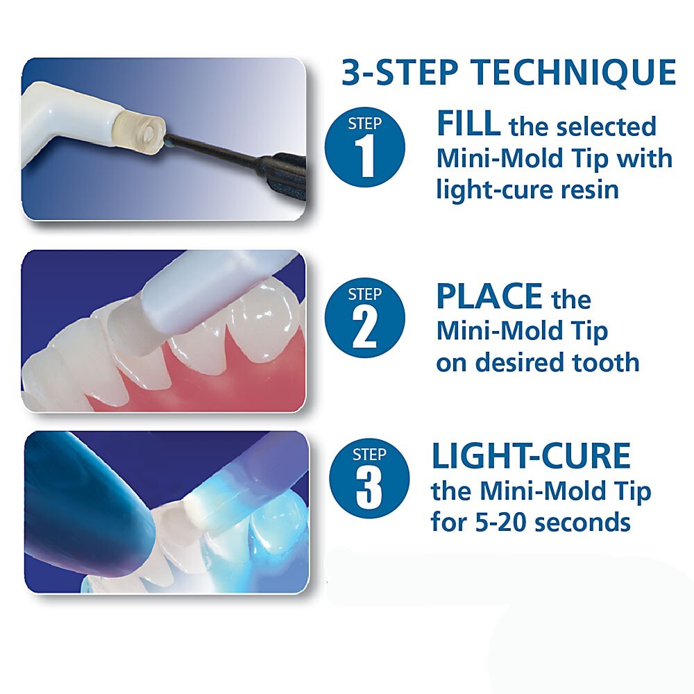 J&J Ortho Dental Orthodontic Smart Mold Assorted Kit (6/pk)