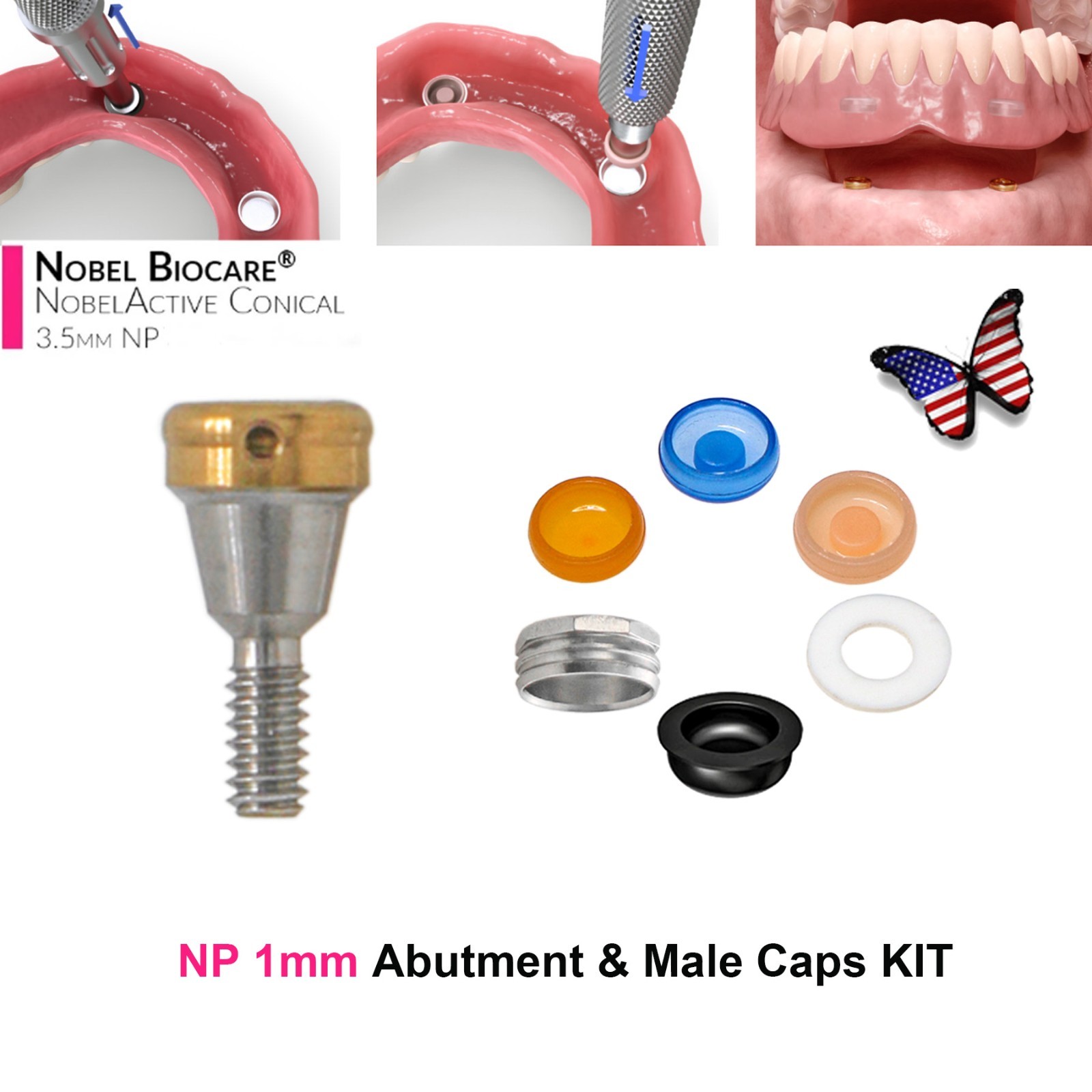 US Zest Legacy Locator Abutment Fits NobelActive Conical GH1-5mm PEEK Retention