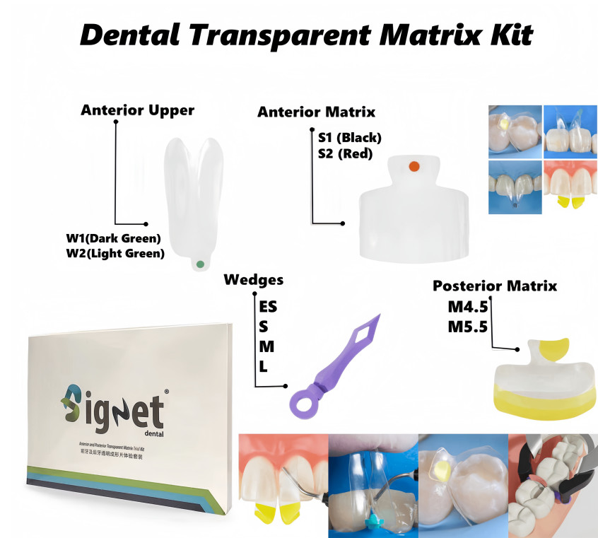 Dental Transparent Matrix Bands Clear Matrices Anterior Molar Bow Front Bioclear