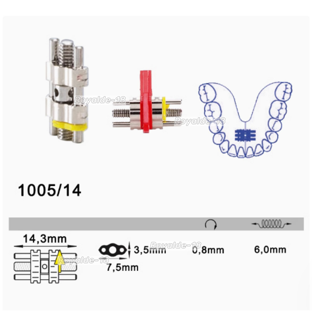 LEWA Dental Orthodontics Two-Way Expansion Screw Stainless Steel Standard/M Size