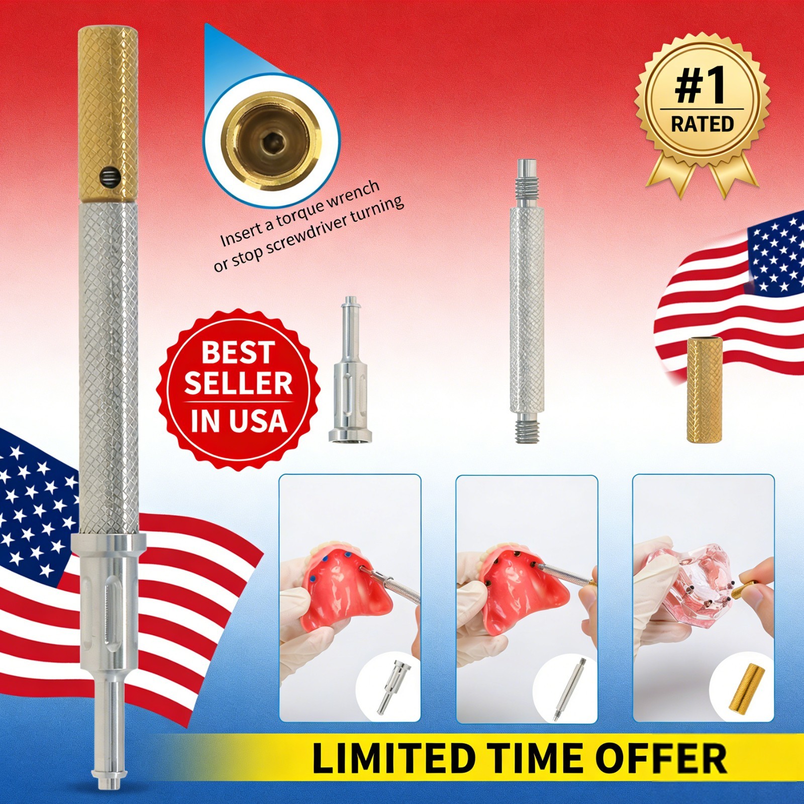 US Dental Fit Zest Anchors Locator Retention Caps Range & Core Tool Overdenture