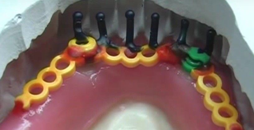 DSI Dental Lab Fixture OT Box Micro Castable Overdenture Ball Attachment Kit