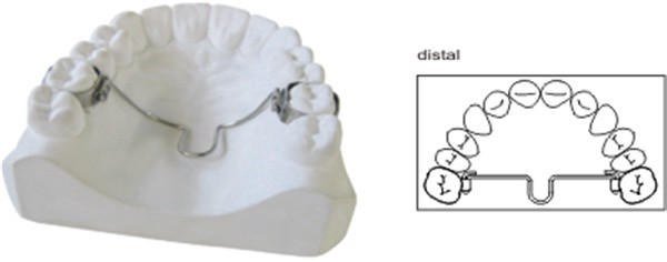 J&J Ortho™ Dental Orthodontic Palatal Arch (5/pk)