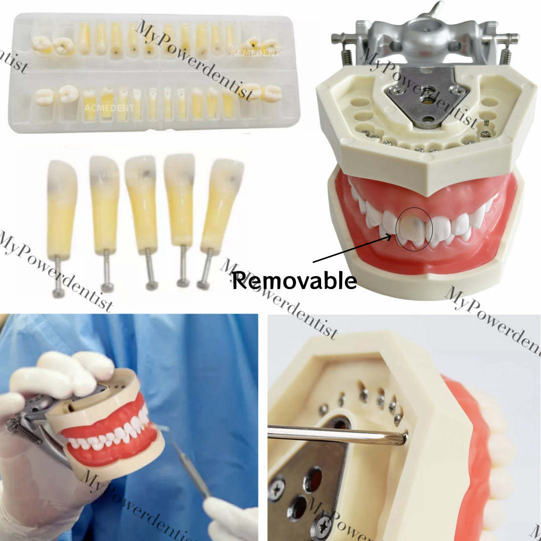 Dental Model DP Articulator Typodont Removable Teeth Kilgore NISSIN Style Study