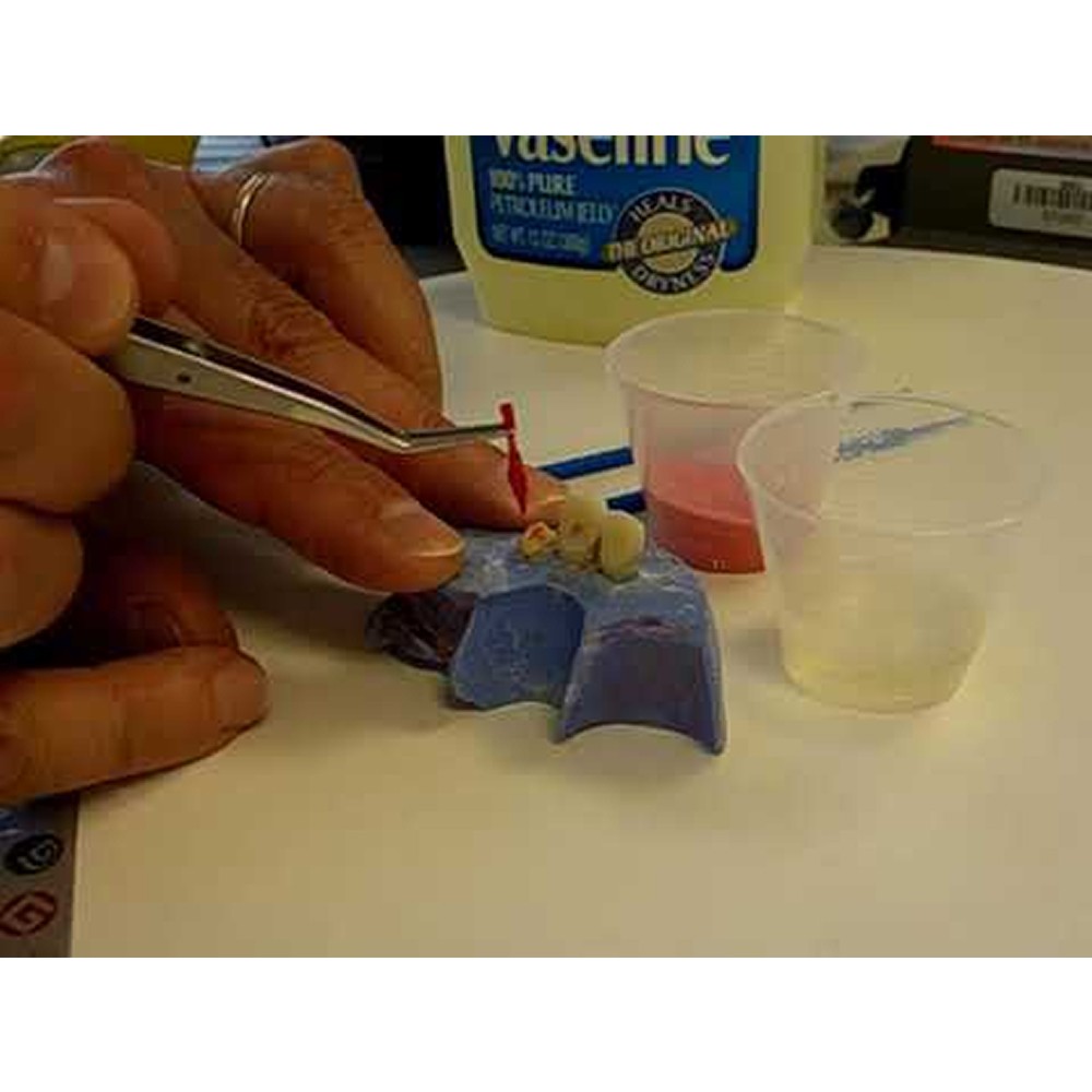 GC Pattern Resin 1-1 Package Acrylic Die Material