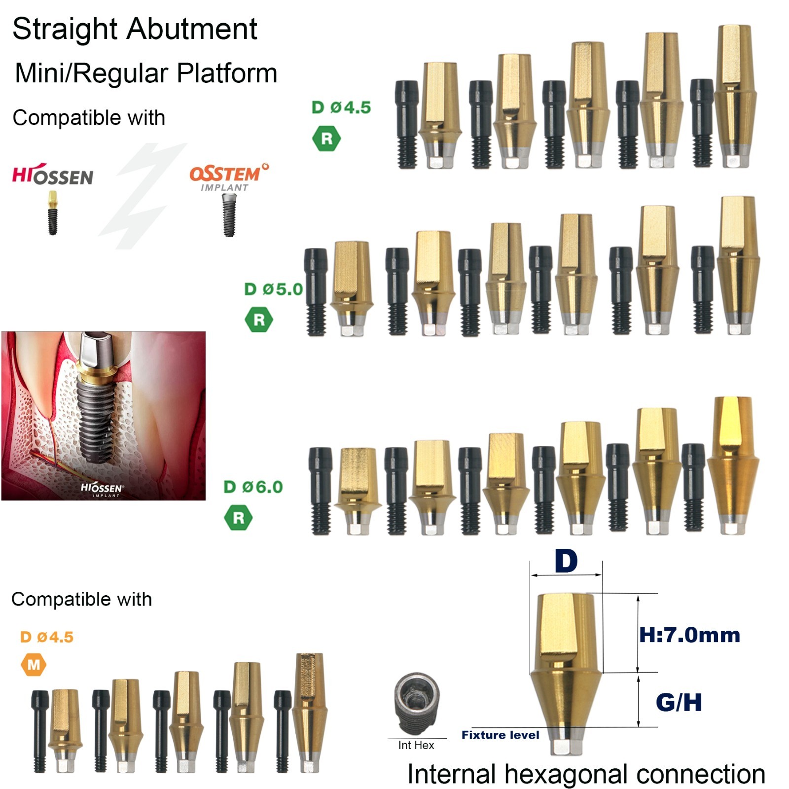 Hiossen Mini/Regular Straight Abutment 7mm H W/Screw Internal Hex System Dental