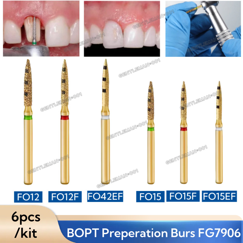Dental BOPT Preperation Burs Vertical Diamond FG7906 Oriented Technique 6pcs/kit