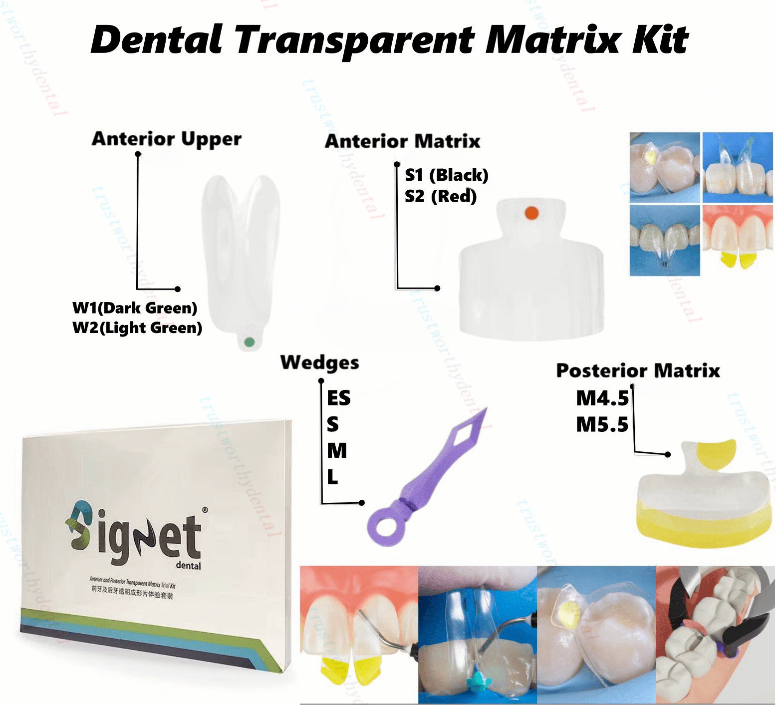 Clear Matrix Dental Anterior Matrices Posterior Class II Fit BioClear Fit Biofit