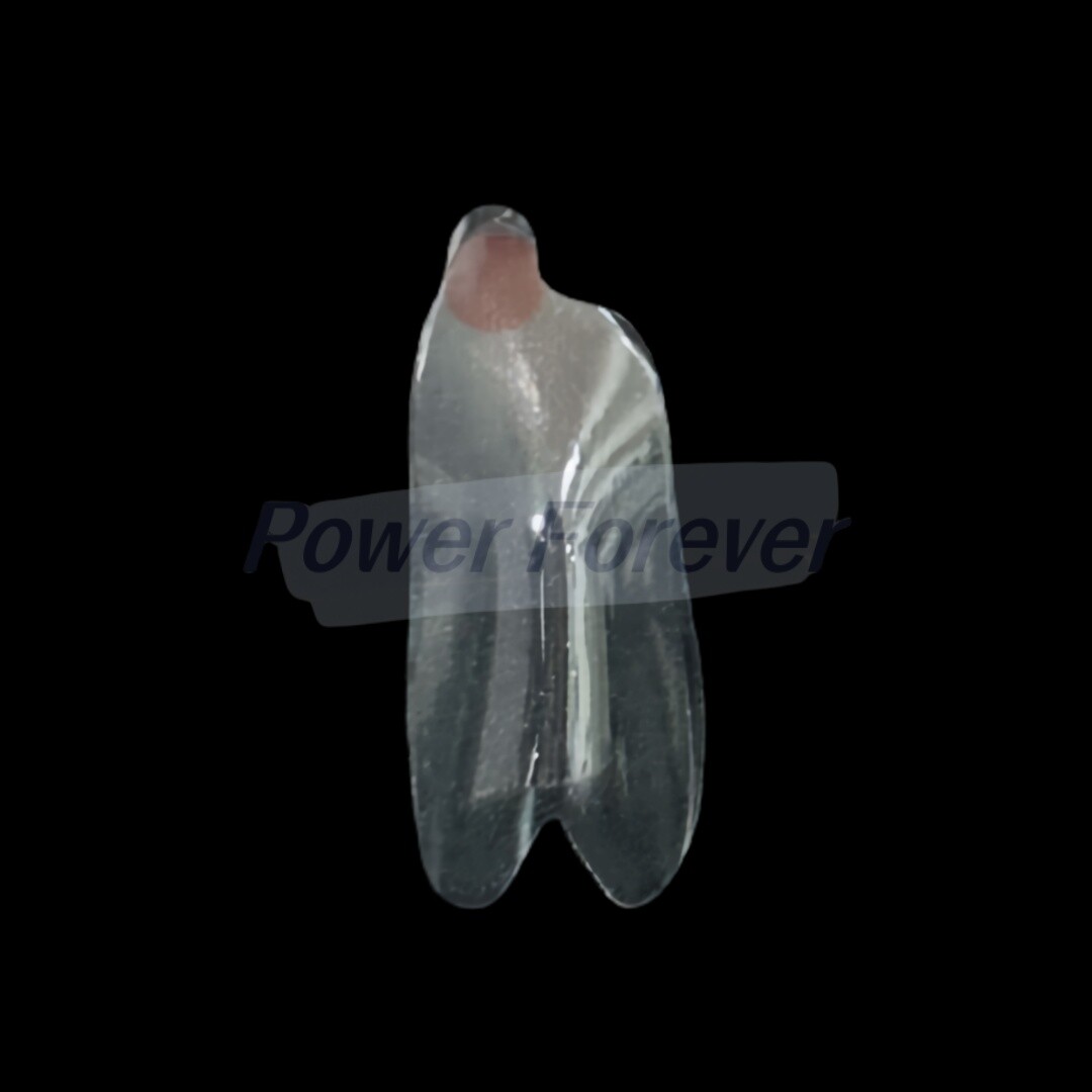S2 Dental Anterior Distal Matrix Clear BT Bow Maxillary Matrices Contoured