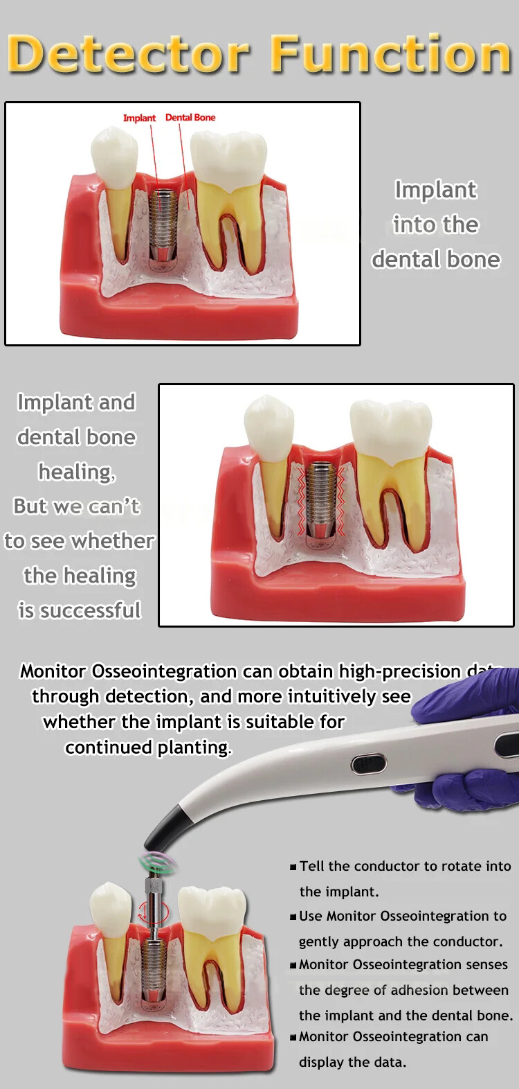 Dental Monitor Osseointegration RFA Inplant Stability Measurement Test Unit ISQ