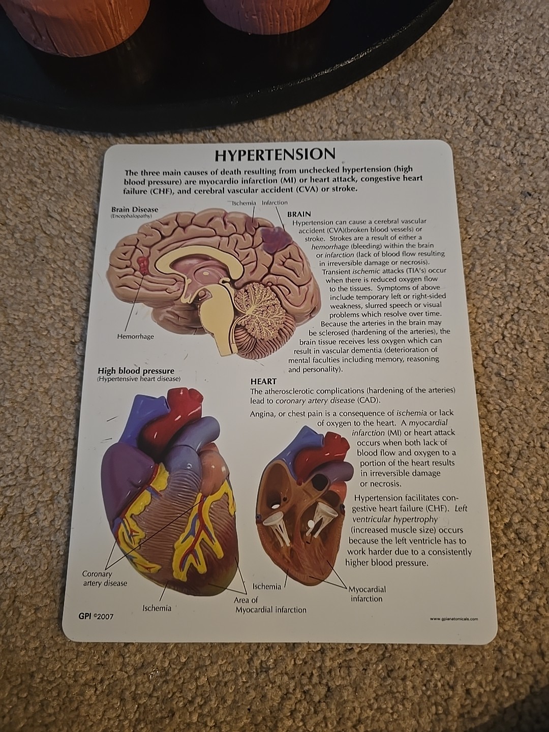 GPI Anatomical Heart Model, 2 Part – GP2500 With Card And Tray