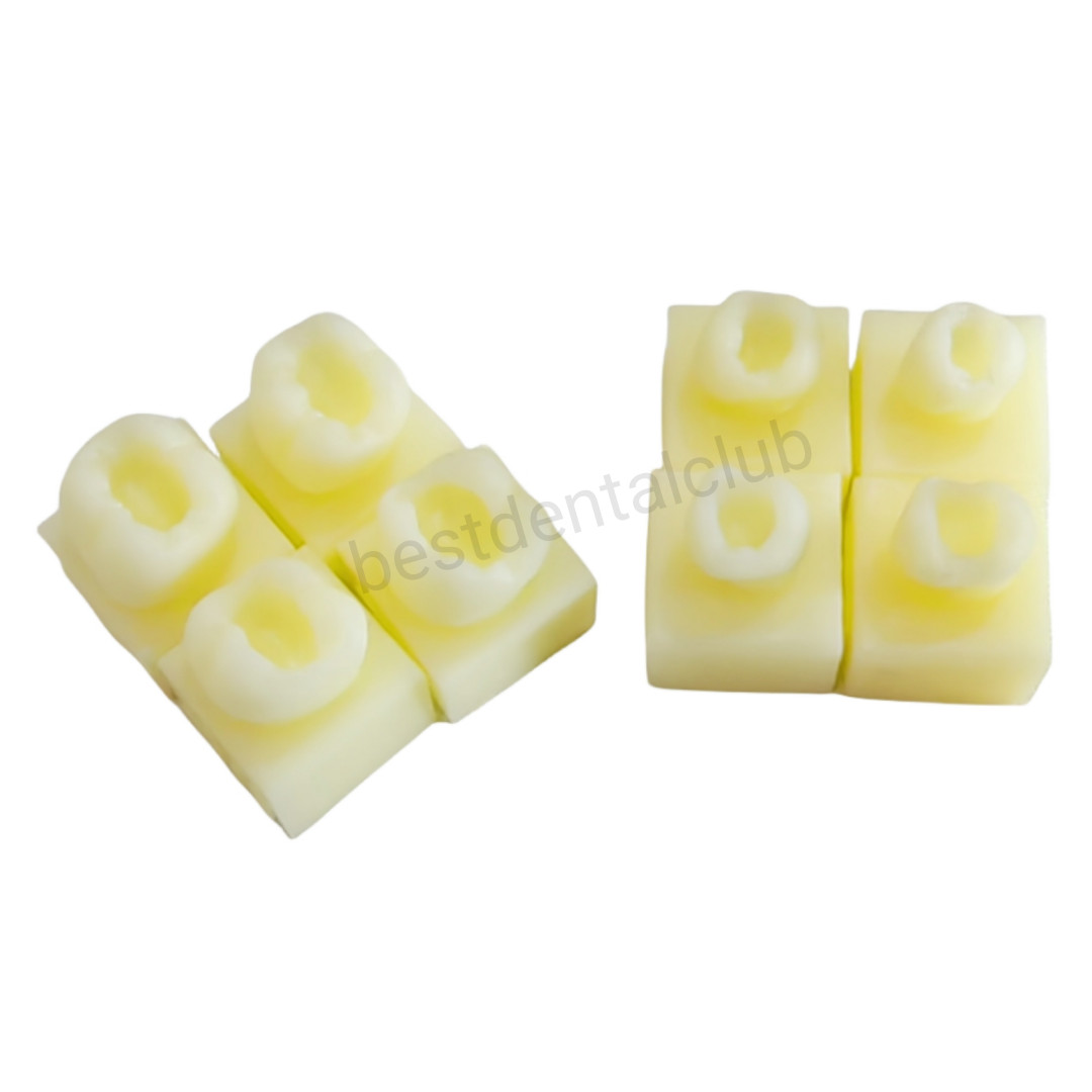 1Set Dental Molar Caries Decay Teeth Model Composite Resin Restore Tooth Simulat