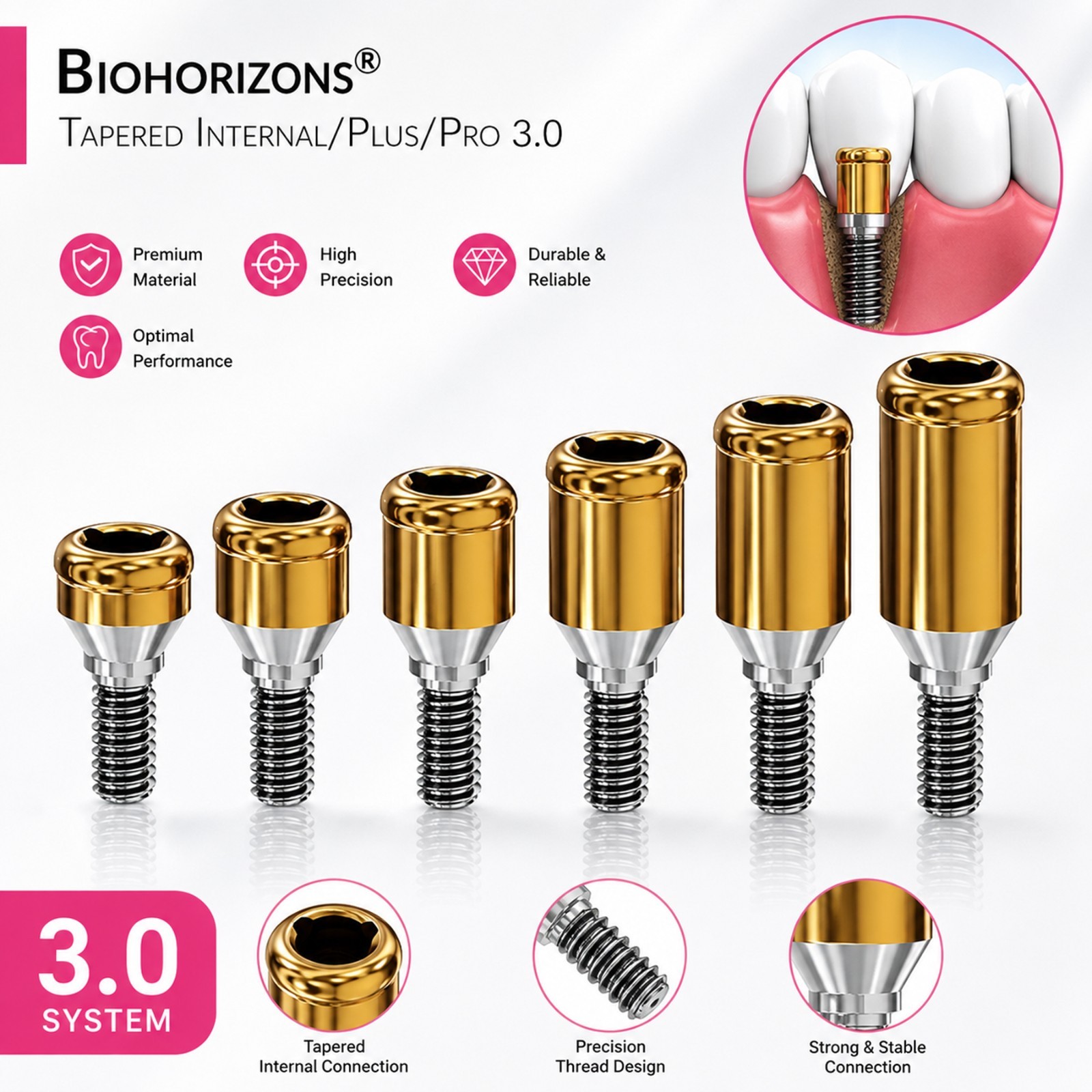 US Dental Locator Abutment Multiple Implant Hiosse/Nobel/Zimmer/BioHorizons/ITI