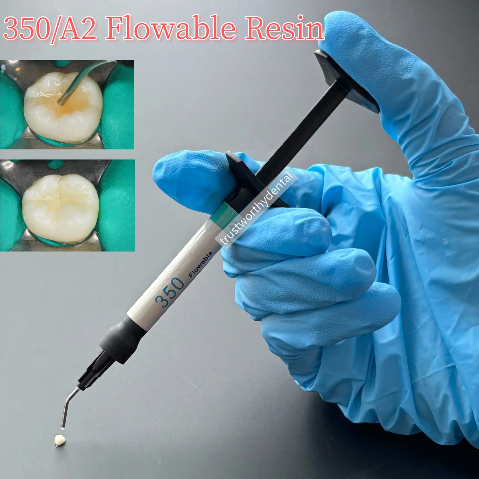2ml Dental 350 A2 Flowable Resin Light Cure Flowable Restorative