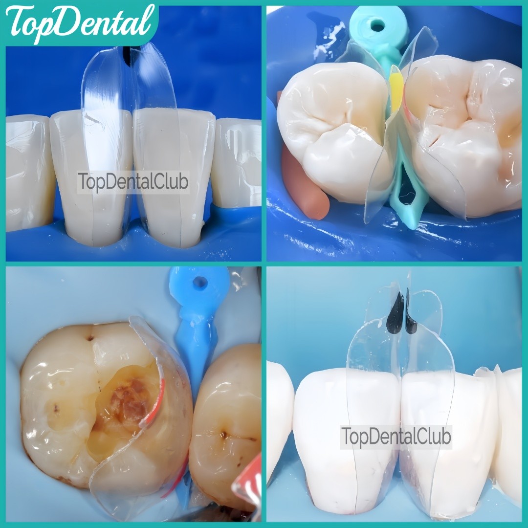 USA Clear Matrix Dental Anterior Posterior Transparent BT Matrices Fits BioClear