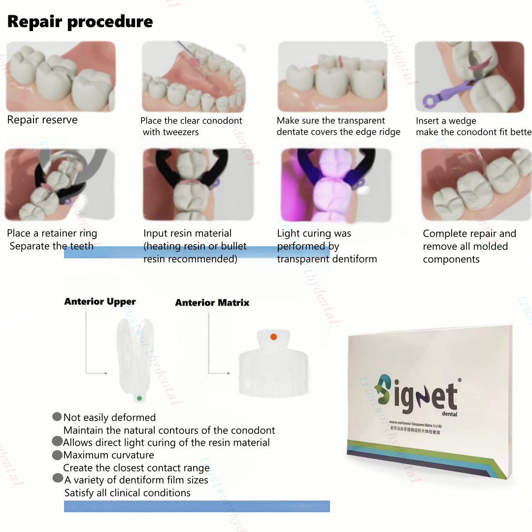 Clear Matrix Dental Anterior Matrices Posterior Class II Fit BioClear Fit Biofit
