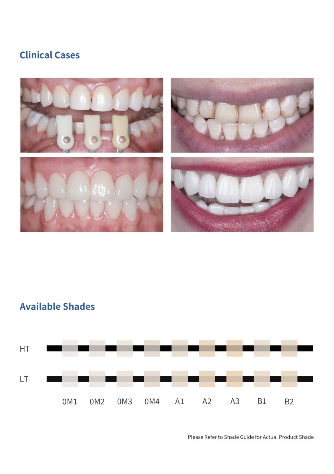 C14 Dental Emax Ceramic Blocks Lithium Disilicate Block CAD/CAM CEREC-5Pcs/BOX