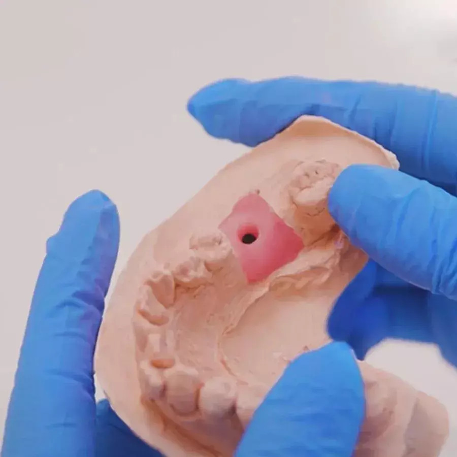 Vincismile Perfit A-Silicone Gingival Mask Synthetic Rubber-Based Material.