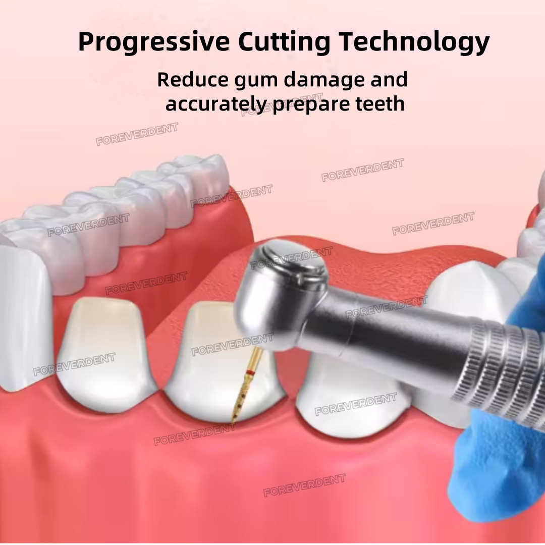 Dental BOPT Preperation Burs Vertical Diamond FG7906 Oriented Technique 6pcs/kit