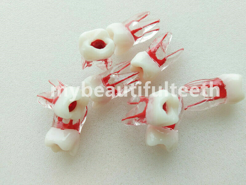 Dental Molar Endo Master Root Canal Study Model RCT Practice Block Pulp Cavity