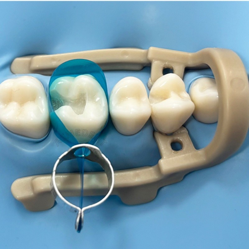 Posterior Matrices Dental Matrix Bands Ring Molar Premoar Matrice Strips LuciFix