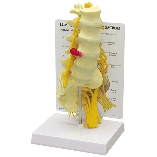 GPI 1700 Life-Size Lumbar Vertebrae with Sacrum Anatomical Model Herniated Disc