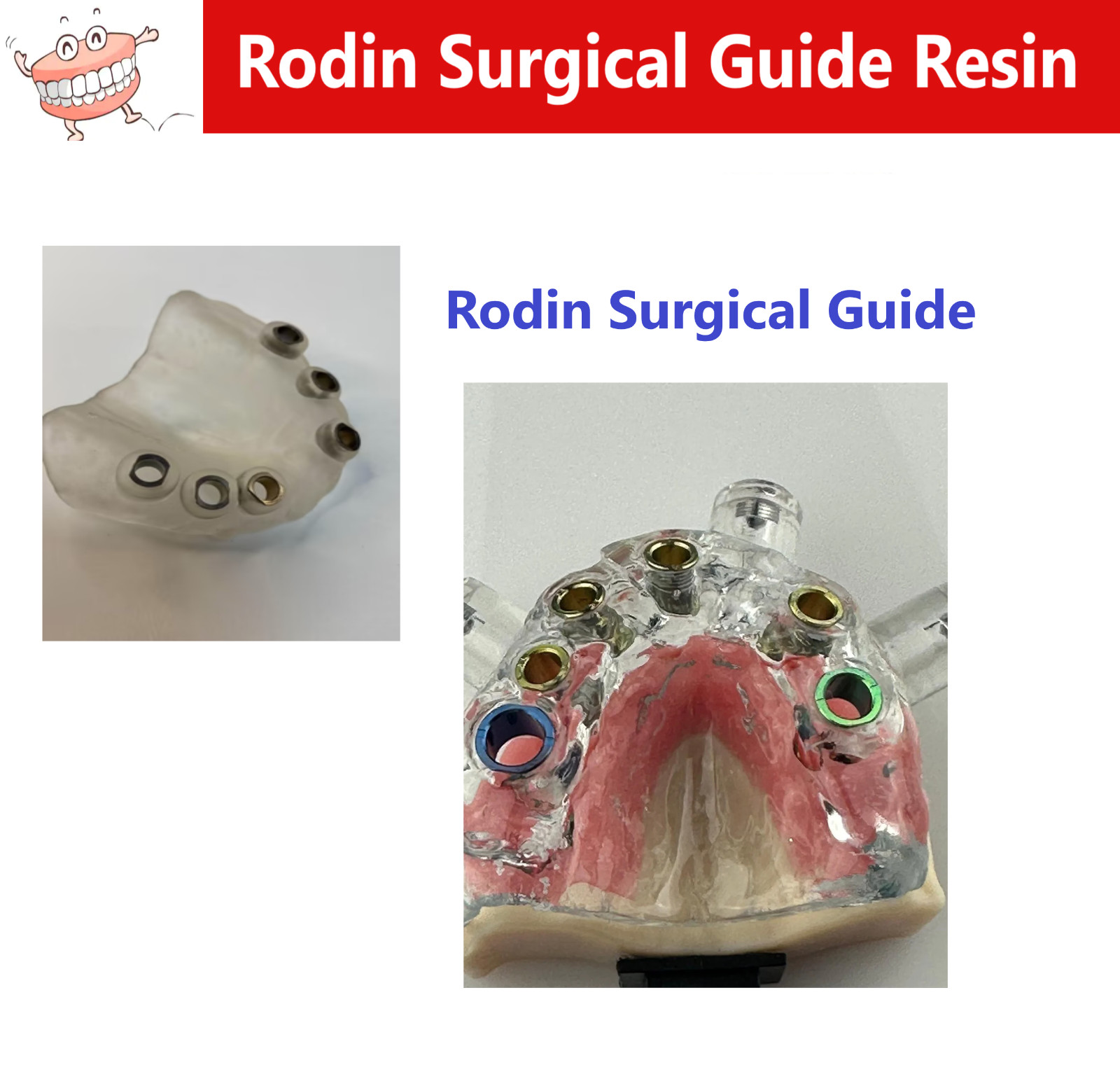 3D Resin Rodin® Surgical Guide 2.0 Robust Resin, Creation Full-arch & Quadrant