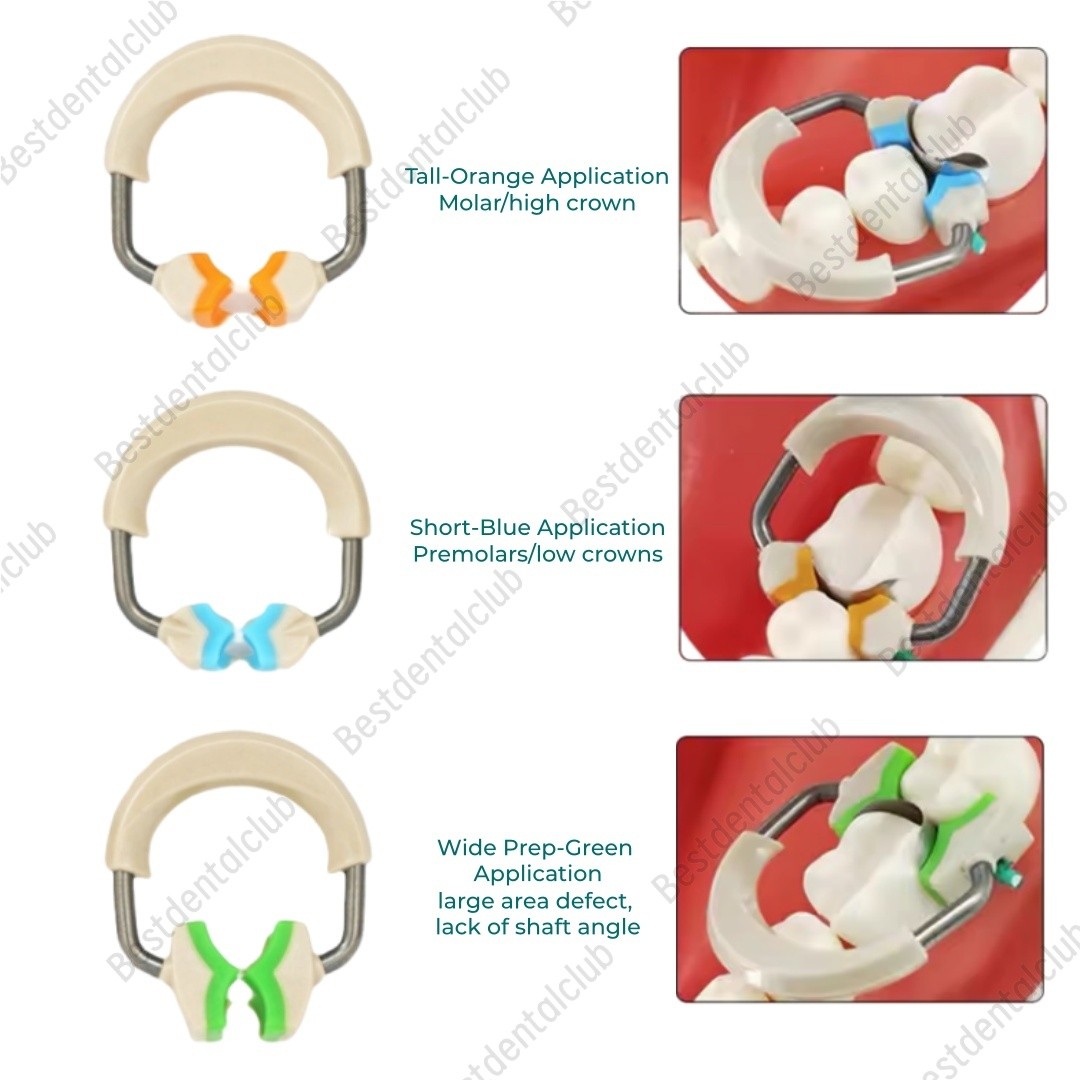 Dental Matrix Bands Ring Sectional Matrice Clamp Wedges Fit Garrison Palodent V3