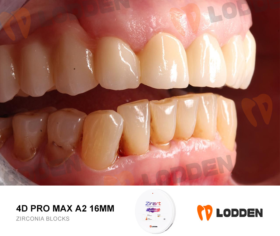 Dental Zirconia Blocks CADCAM System 4D PRO MAX Multilayer Ceramic Disk 8 Layers