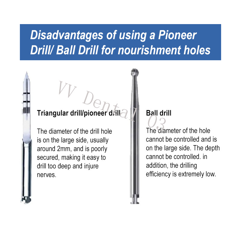 Dental Nutrient Drills GBR Drilling Promote Bone Growing Nourish Implant Holes