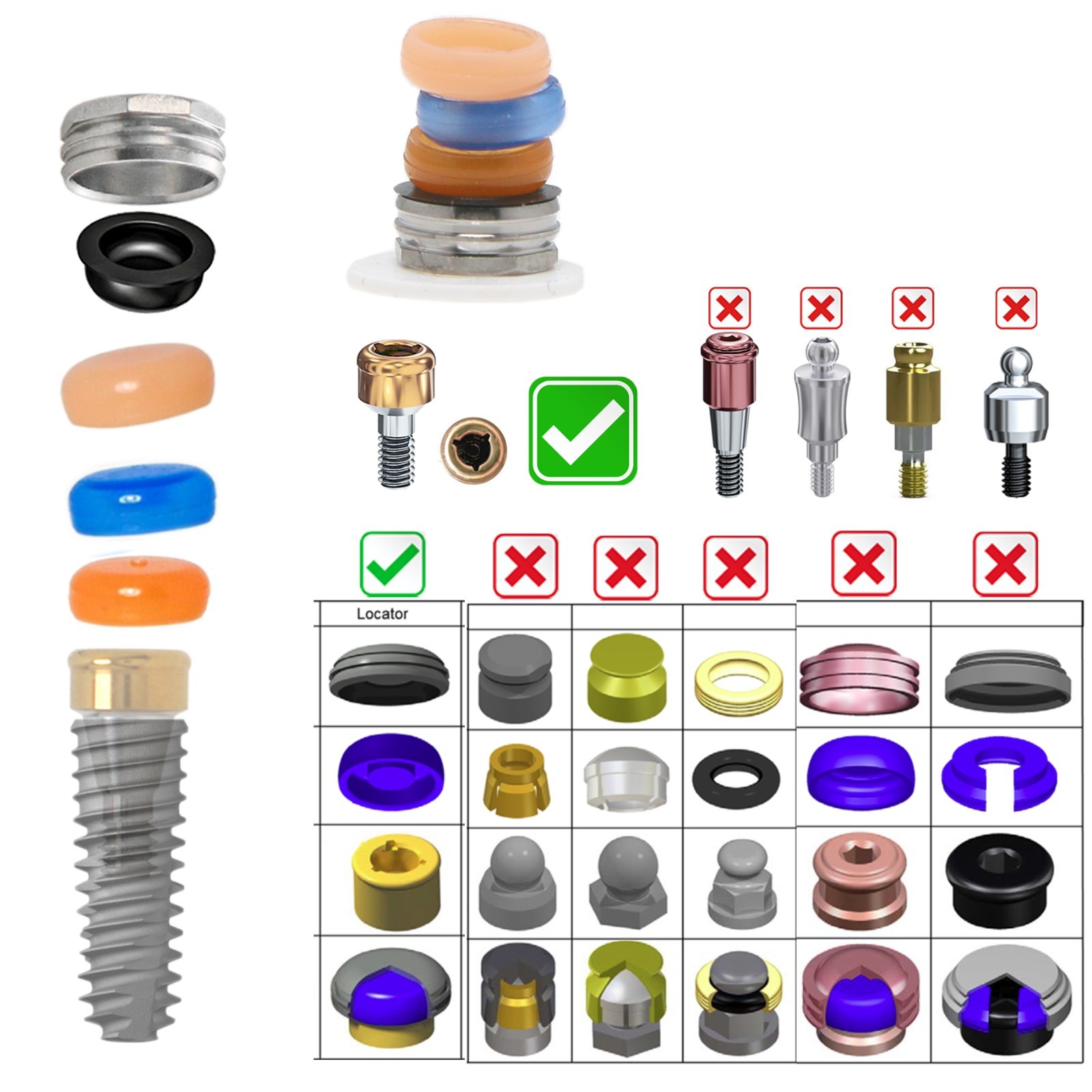 20Pcs Dental Overdenture Locator Abutment Replacement Retention Cap Inserts Set
