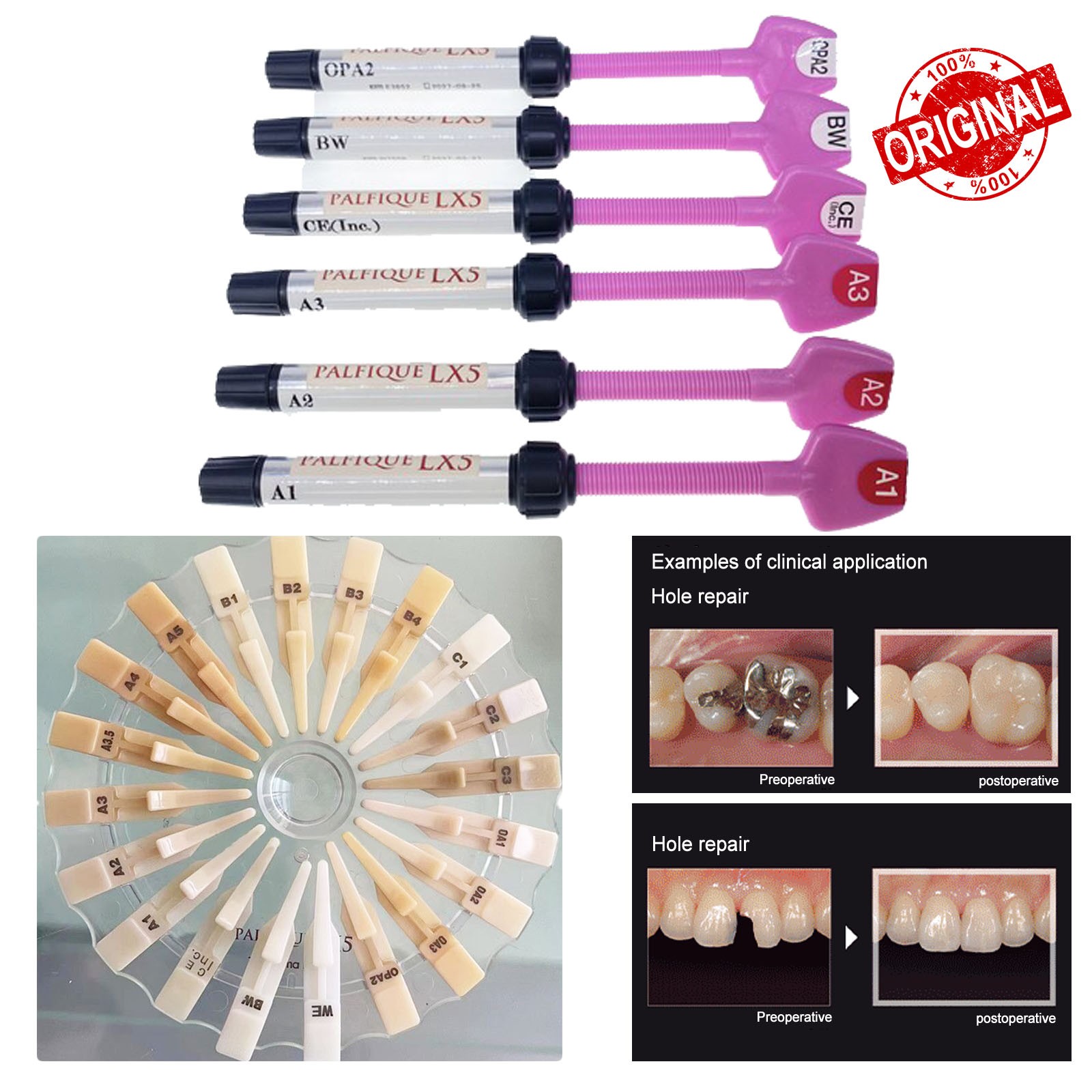100% Palfique Tokuyama LX5 Resin Based Dental Restorative Composite 3.8gm FDA