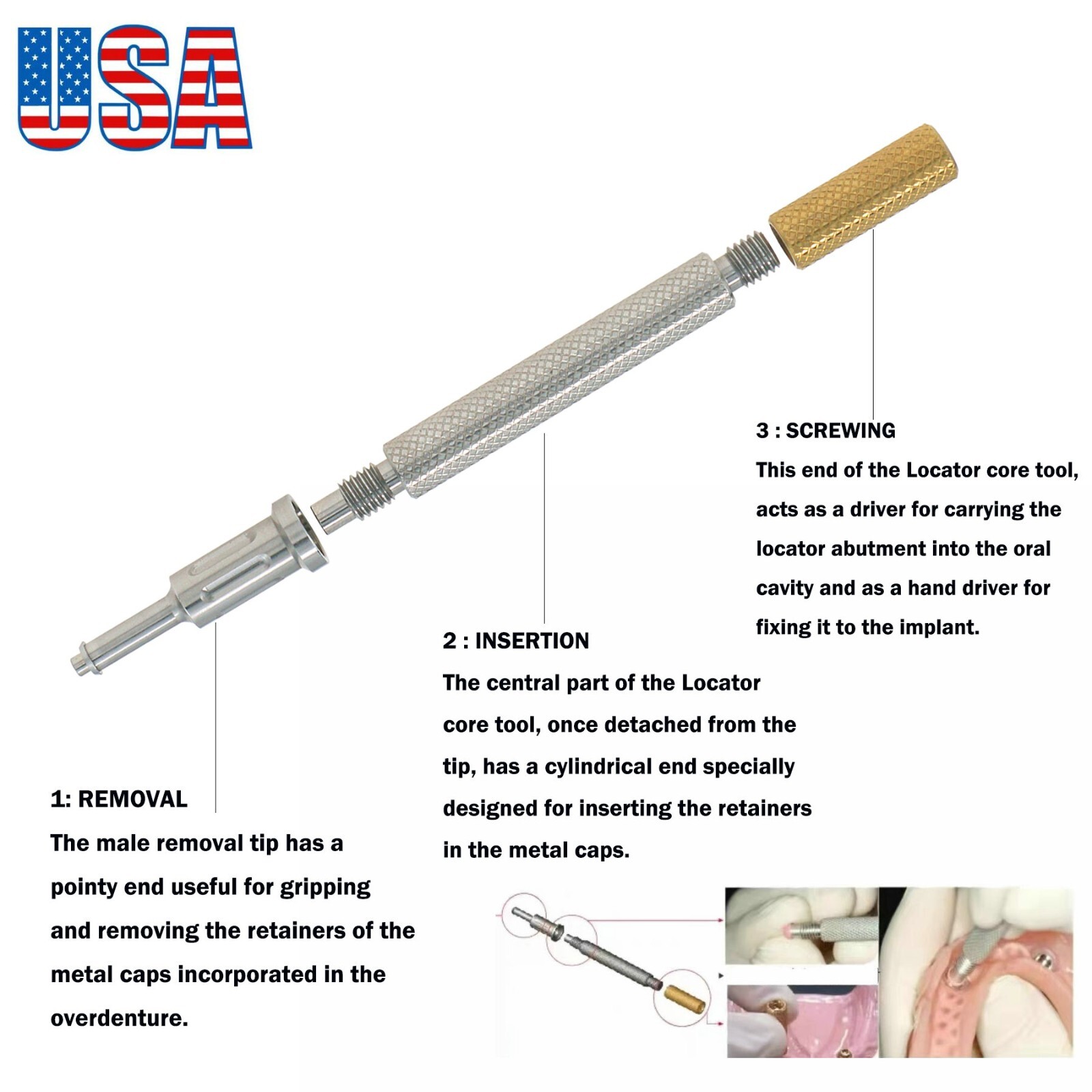 US Regular Locator Attachment Abutments for Hiossen ET Osstem TS 3.0-5.0mm GH