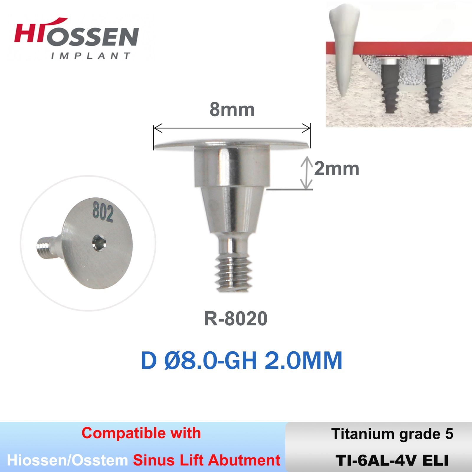 Hiossen R Sinus Lift Abutments Ø6-9mm Titanium 4-Leaf Design Fit Osstem/DIO UF R