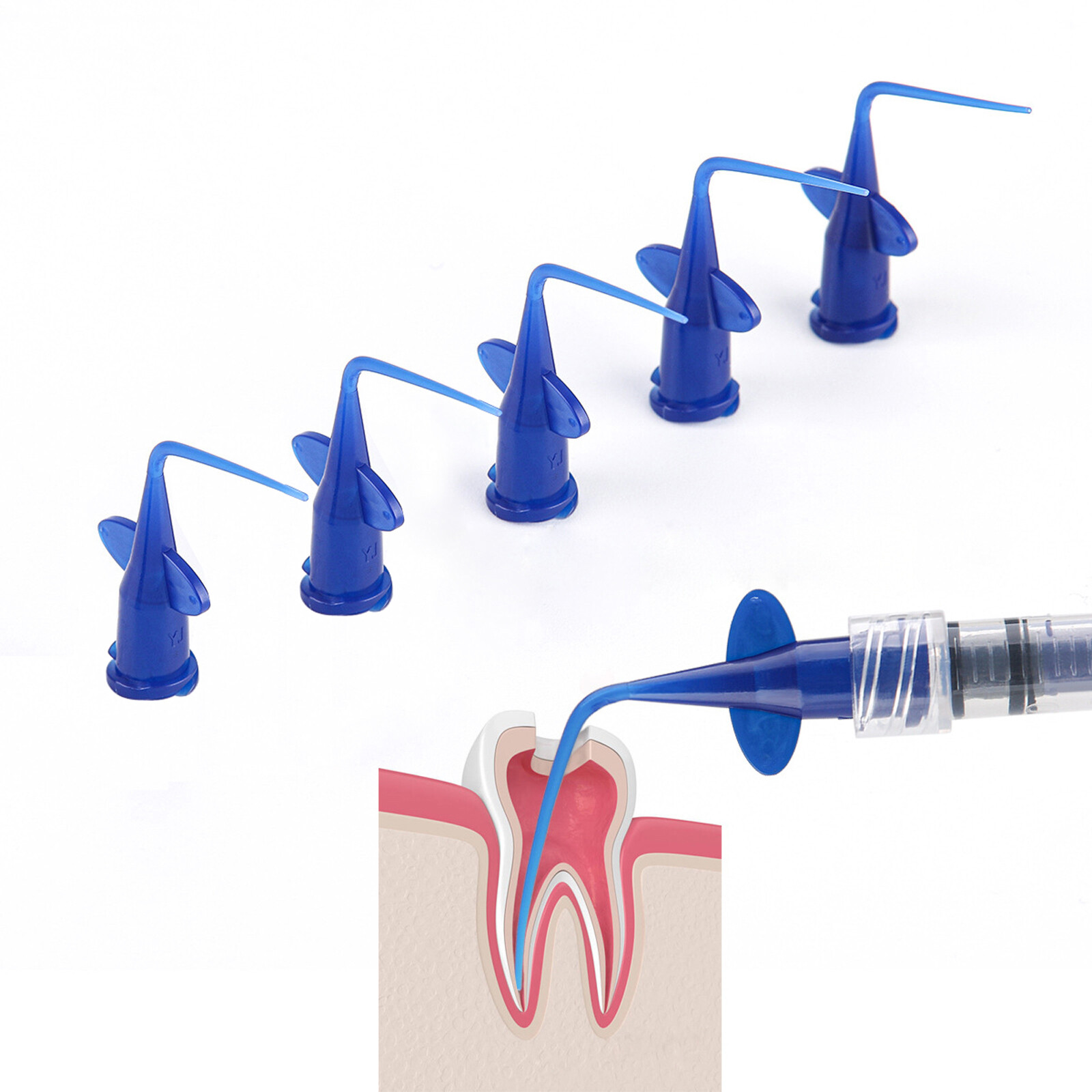 Dental Vitapex Premixed Calcium Hydroxide root canal filling irigation tips