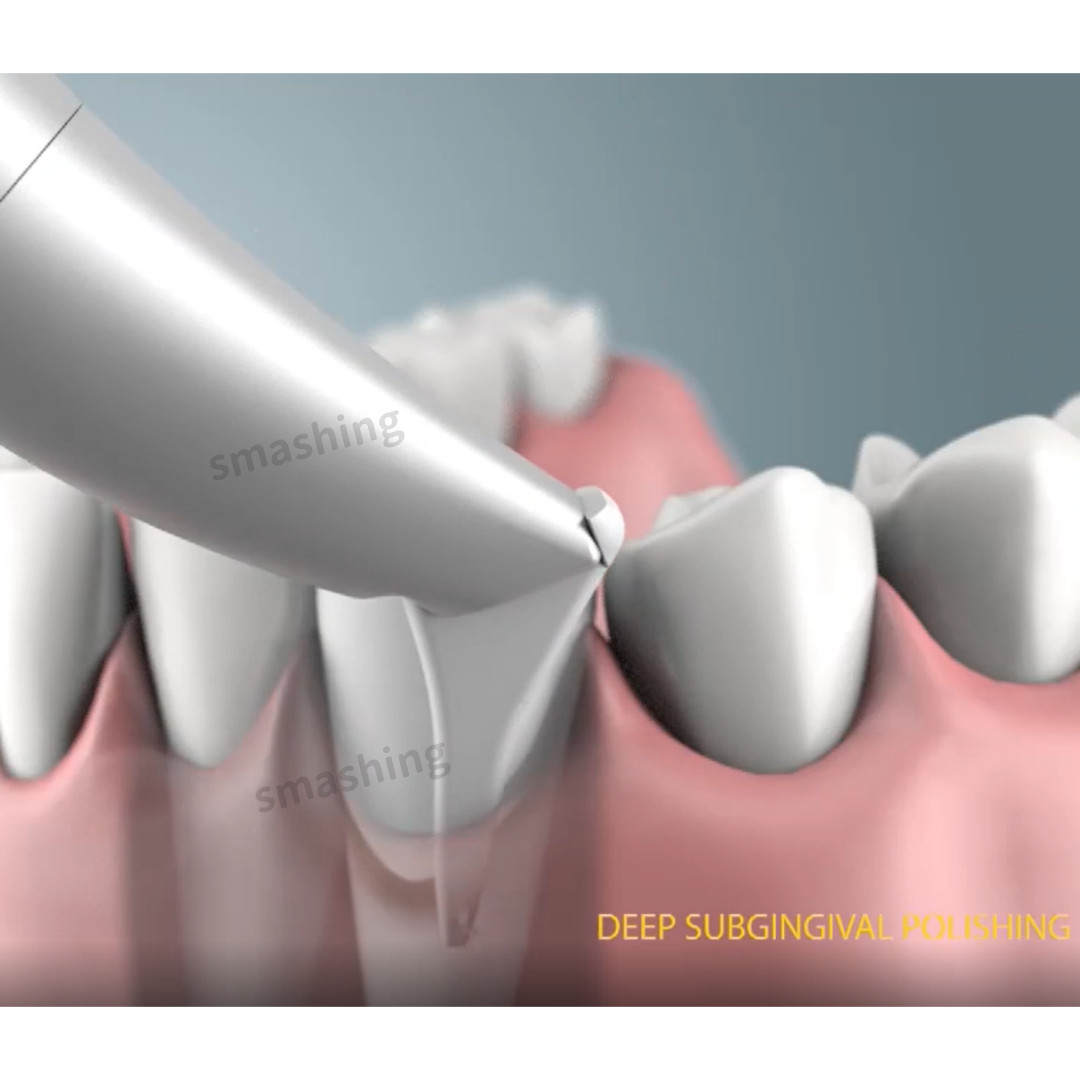 Dental AirFlow Polisher Handpiece Supragingival Subgingival Fit EMS AIR-FLOW