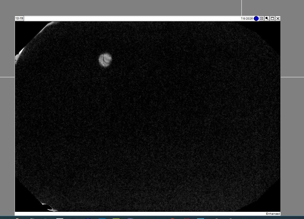 Dexis/Kavo IXS Size 2 Sensor _SEE PICTURES AND IMAGES_