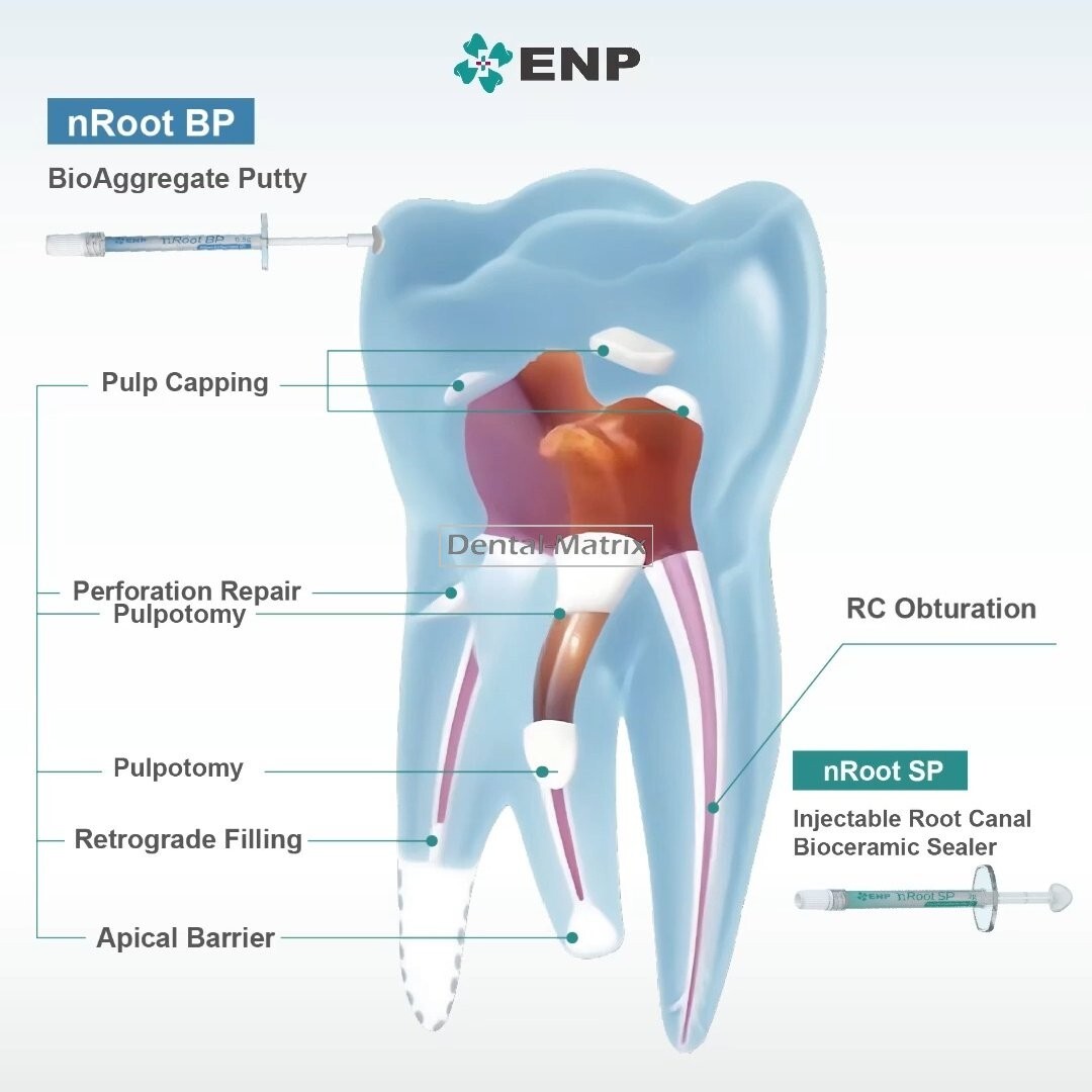 Root Canal Bioceramic Repair BP Restorative Material Filling Cement Sealer SP