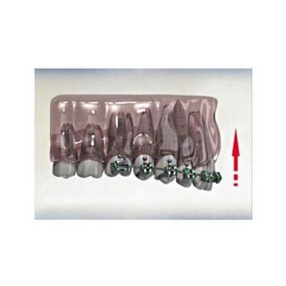 10pcs Dental Morelli NiTi Heat-Activated Thermo Plus Archwire Rectangular Jaw