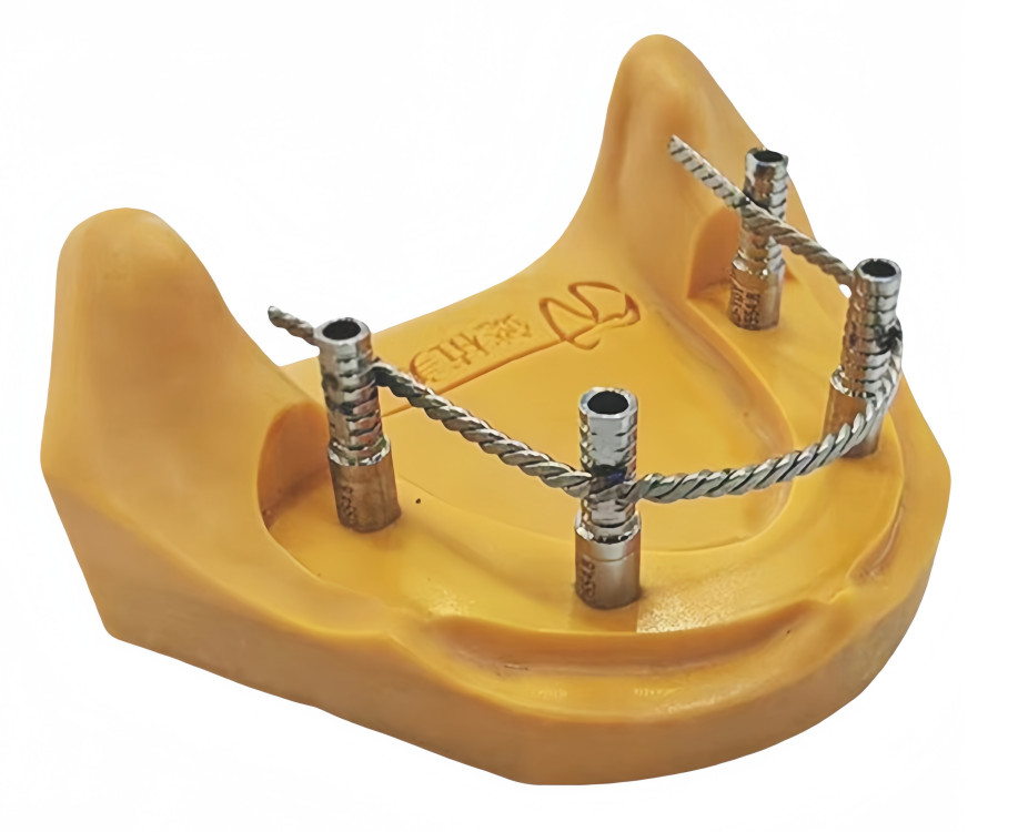 Dental Twist Strengthener Wires for Im plant 4 inch Length Similar Bredent