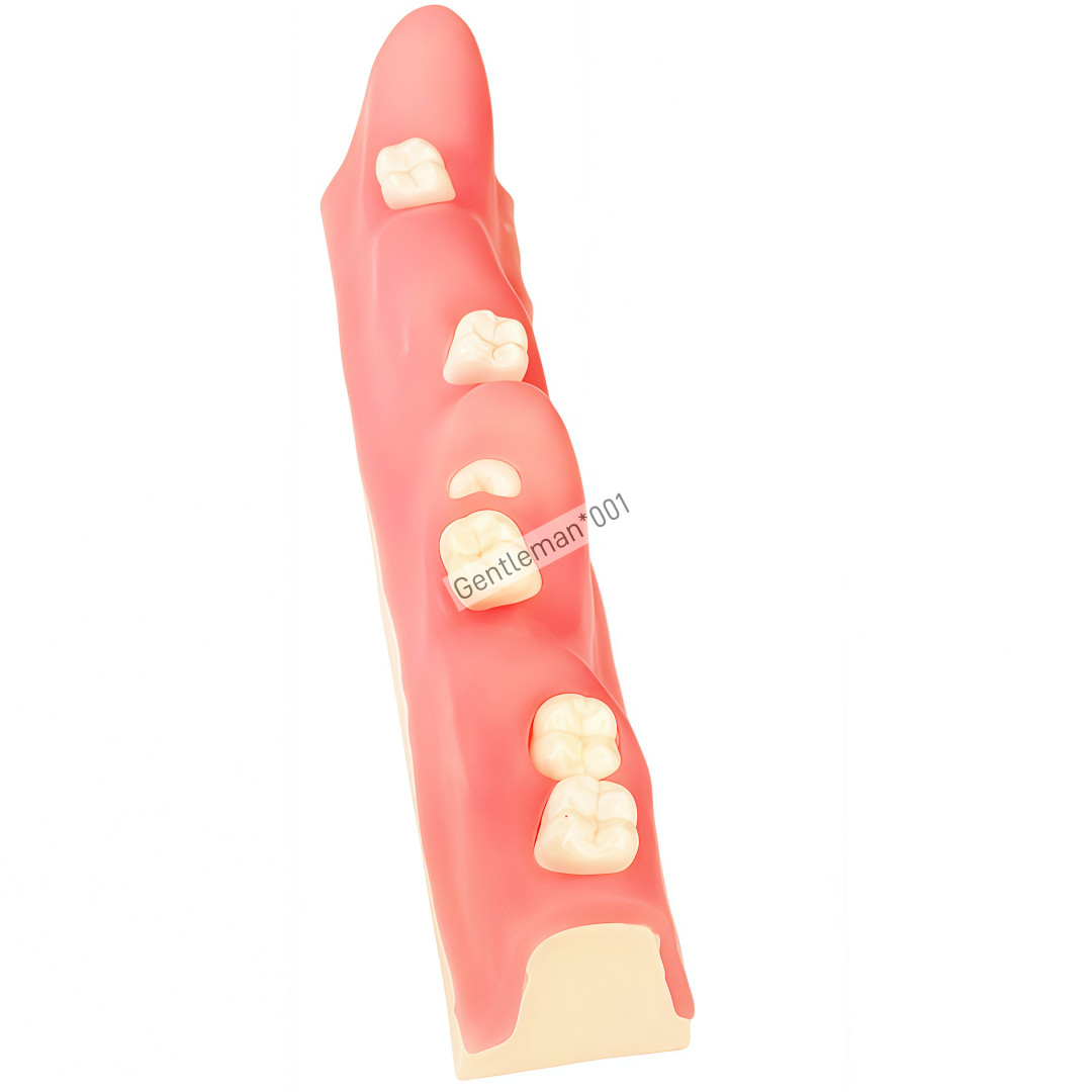 Dental Impacted Tooth Model Extraction Unerupted Tooth Practice Trainin M8038