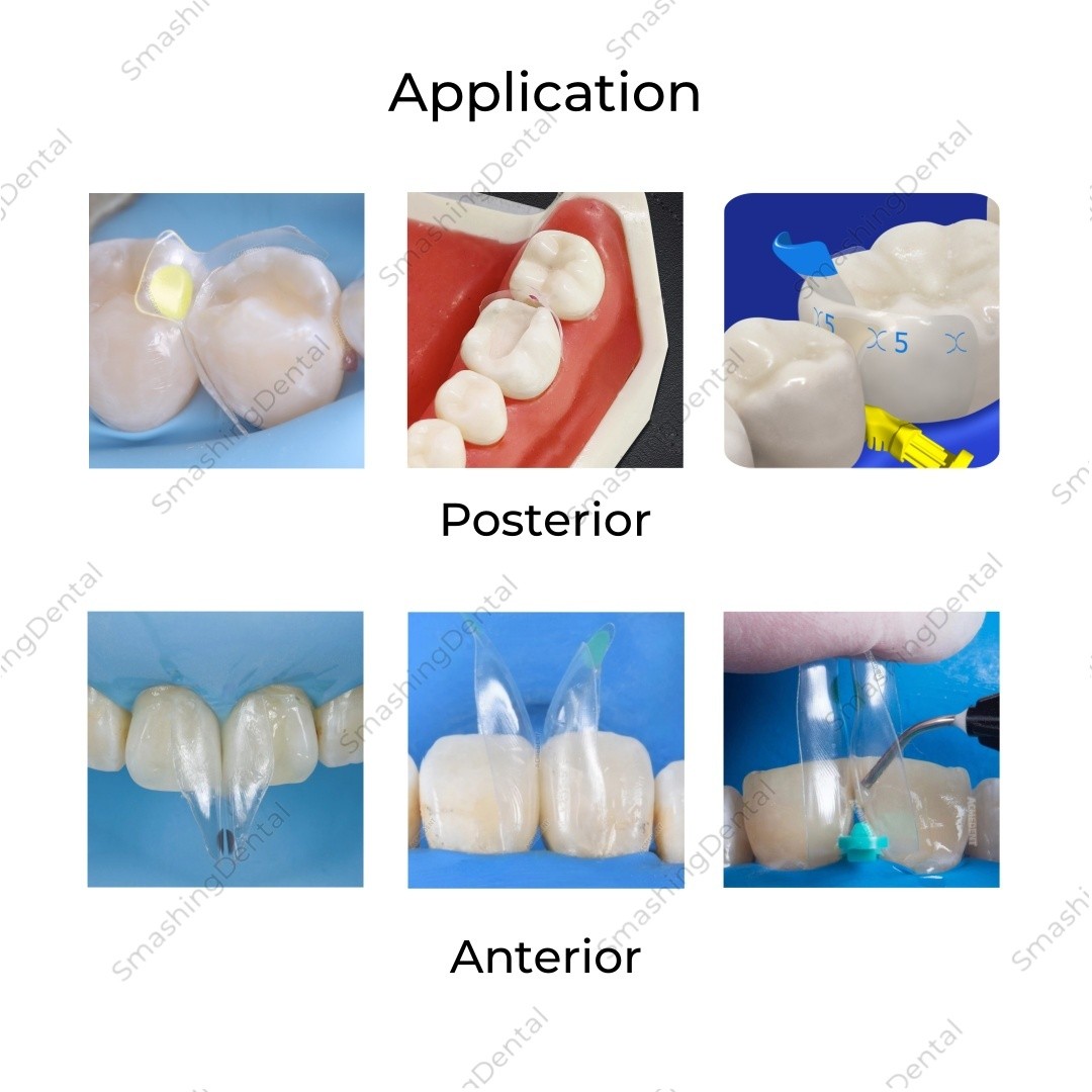 10Pc Clear Matrix Dental Anterior Posterior Transparent BT Matrices Fit BioClear