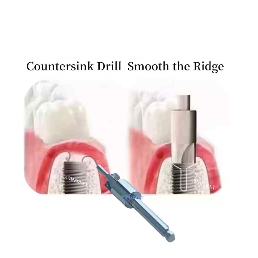 Dental Level Bone Profiler Remover Edge Dresser Drill Drills Remover 4.5/5.2mm