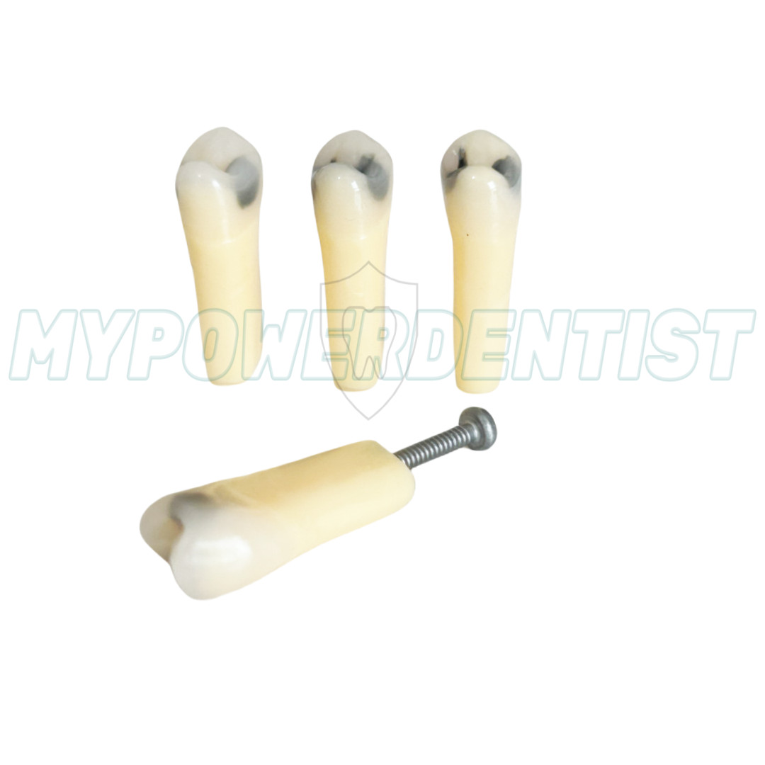 Dental Cavity Teeth Model Tooth Teaching Caries 25# Compatible Frasaco AG-3